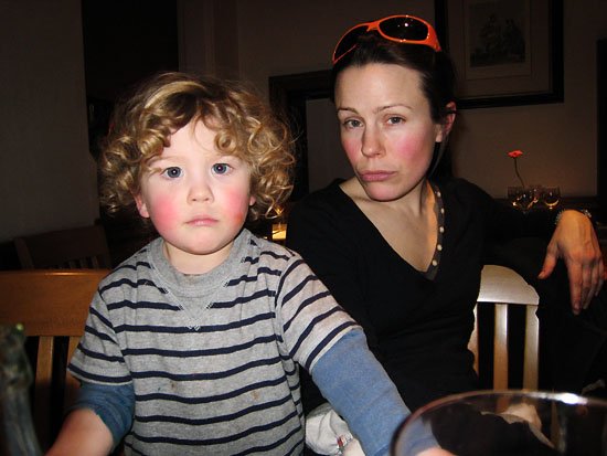 rosy cheeks